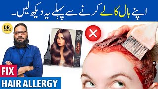 Hair Dye Allergy Ka Ilaj  Kizab LaganaBaal Kale Karne Ke Nuksan  Dr Ibrahim [upl. by Farhi]