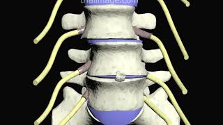 Intertransverse Fusion of the Lumbar Spine ALIF Part 4 Animation by Cal Shipley MD [upl. by Cleo]