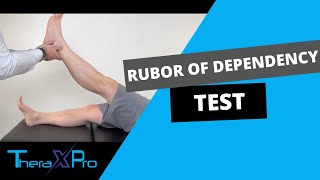 Rubor of Dependency Test  Buergers  Peripheral Arterial Disease [upl. by Idou175]