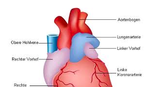 Herzinfarkt Myokardinfarkt Herzschlag [upl. by Acinoed]