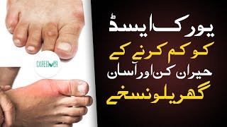 Uric Acid Treatment  Uric Acid ka ilaj uric acid home remedies  How to Reduce Uric Acid [upl. by Riggins597]