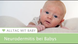 Neurodermitis bei Babys So erkennst du es [upl. by Aire587]