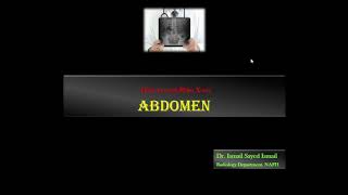 How to read Abdomen Xray Dr Ismail Sayed Ismail [upl. by Jacqui]