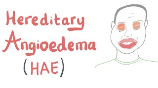 Hereditary Angioedema HAE [upl. by Toombs]