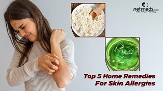 5 Best Natural Remedies For Skin Allergies [upl. by Aihsetal963]