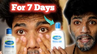 I Tested Skin Doctors Recommending Cetaphil Face Wash For 7 Days • Genuine Review • Skin Care [upl. by Ceevah]