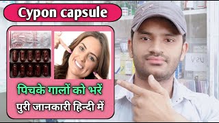 Cypon capsule use dose benefits and side effects full review in hindi cyproheptadine [upl. by Toth369]