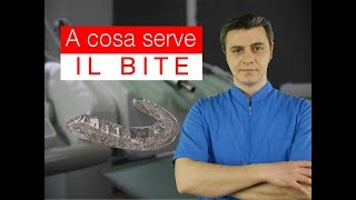 A cosa serve la placca di svincolo [upl. by Airtap]