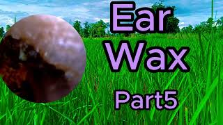 ear wax removal asmr [upl. by Arayt]