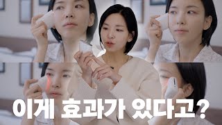 피부과 가기 힘들면 이거라도 하세요  메이크온 스킨라이트테라피3 [upl. by Jaela]