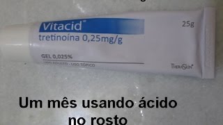 Como estou usando ácido tretinoína  Vitacid 1 [upl. by Tripp]