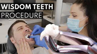 Wisdom Teeth Extraction PROCEDURE  How to Prepare What to Expect amp Cost [upl. by Stormi]