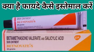 Betnovate S Cream Uses  Betamethasone Valerate And Salicylic Acid Skin Ointment गोरा होने की क्रीम [upl. by Hnid756]