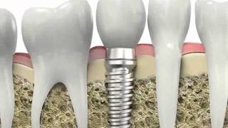 Endodontics and Periodontics Associates PA mouth care Tampa FL [upl. by Anotal729]