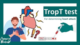 TropT test  What if Trop T test is positive  Troponin T blood test [upl. by Meggy]