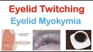 Eyelid Twitching Eyelid Myokymia  Triggers Pathophysiology Symptoms Diagnosis Treatment [upl. by Evaleen]