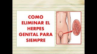 🔥😱 como ELIMINAR el HERPES GENITAL PARA SIEMPRE 🦁🔥 4 REMEDIOS naturales para curar el HERPES GENITAL [upl. by Favin]