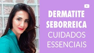 Dermatite Seborreica cuidados essenciais [upl. by Messab]