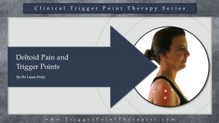 Deltoid Pain and Trigger Points [upl. by Marie-Jeanne290]