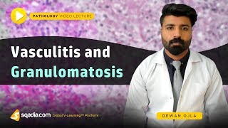 Vasculitis and Granulomatosis  Pathology Medical School  Education Made Easy  VLearning [upl. by Benedix]