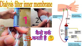 TYPES OF DIALYZER amp MEMBRANE DIALYZER INNER PART  डायलज़र और मेम्ब्रैंन के प्रकार और अंदर के परत🤔 [upl. by Aneger]