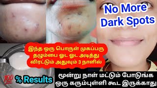 In 3 Days 👍 Remove Acne Scars Dark Spots Pimple Marks Pigmentation 😍 Naturally At Home  In Tamil [upl. by Hoxie]