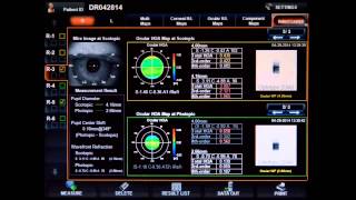 KR 1W Topcon Online University 2 PUPILLOMETRY MAP [upl. by Artenak]