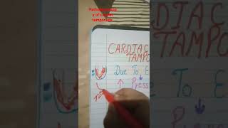 Cardic Tamponade pathophysiology  How it occur [upl. by Naget]