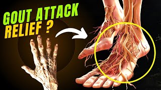 Gout Attack Relief Top 10 Uric AcidBUSTING Foods ✅ [upl. by Thorsten857]