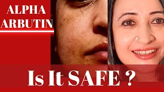 Is Alpha Arbutin Safe in Skin care and Body care Should you stop it After 3 months [upl. by Chap]