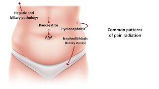 An Approach to Acute Abdominal Pain [upl. by Boeke749]