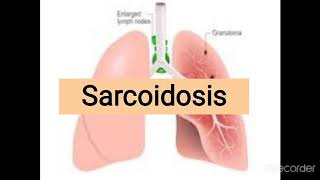 Sarcoidosis  granulomatous lung diseases [upl. by Gnilrets91]