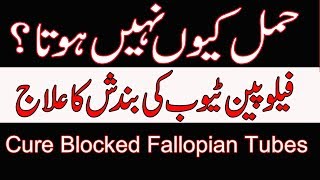 Fallopian Tube Blockage Treatment  Tube Block Ka ilaj By Dr Naveed [upl. by Wachter]