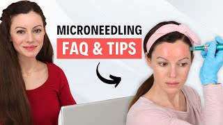 Microneedling FAQ amp MustKnow Tips for Amazing Results [upl. by Bathsheba]