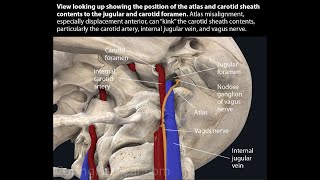 Dog culture damages the Carotid sheath and Vagus nerve Head down posture Dog groomers [upl. by Barstow]