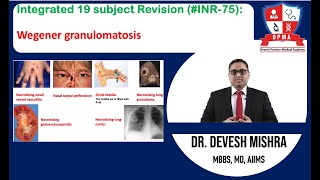 🕉 Integrated 19 subject Revision INR75 Wegener granulomatosis by Dr Devesh Mishra [upl. by Menken]