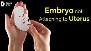 Why embryos dont stick in uterus How is it treated  Dr Rashmi Yogish  Doctors Circle [upl. by Nigem]