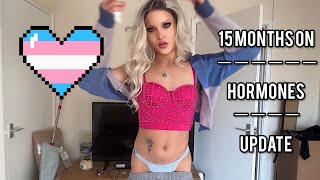 Transgender MTF  15 MONTHS HRT update [upl. by Nosae460]