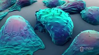 Nanoparticlebased drug delivery in the fight against cancer [upl. by Neirbo]