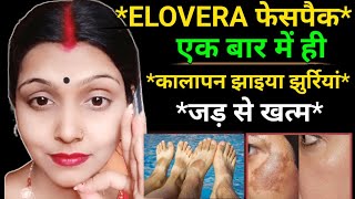 Skin Care Remedy for Melasma Treatment कितनी भी पुरानी झाइयों को 7 दिन में ठीक करें  eloveraface [upl. by Cyrie]