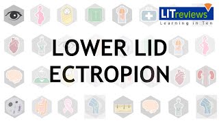 Lower Lid Ectropion [upl. by Leavelle352]