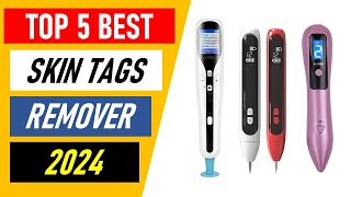 Top 5 Best Skin Tags Remover in 2024 [upl. by Yadroc964]