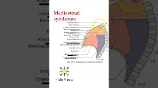 Anatomy Thorax 279 Mediastinal Syndrome structures compression carcinoma Hodgkin lymphoma aneurysm a [upl. by Des]