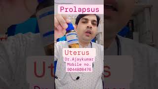 prolapsus of uterus shortvideo doctor viralvideo [upl. by Yziar604]