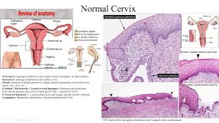 Pathology Made EasySystemic Pathology 10 Female genital system Diseases3 [upl. by Peppard347]