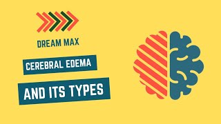 Cerebral Edema and its types  Dream Max [upl. by Binni]