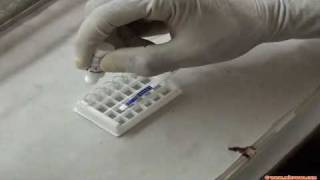 Rapid malaria test [upl. by Rosio]