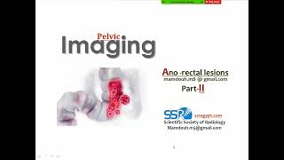 23 Imaging of rectal cancer II Prof Mamdouh Mahfouz [upl. by Nicoline]