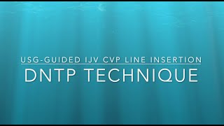 CVP line Insertion using DNTP technique [upl. by Trescott299]