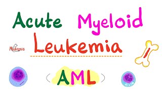 Acute Myeloid Leukemia AML  Auer Rods  Myeloperoxidase Positive  Hematology amp Oncology Series [upl. by Anauqahc]